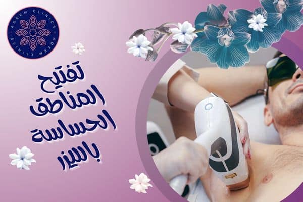 تفتيح المناطق الحساسة بالليزر