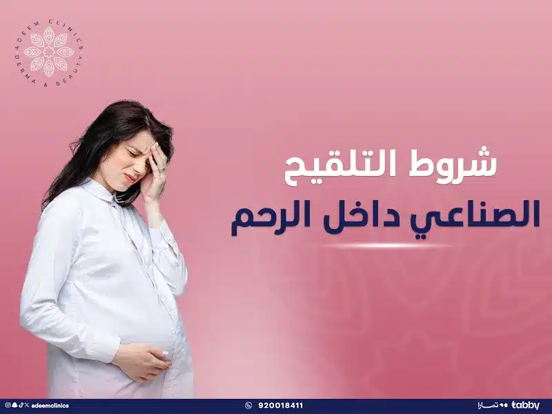 شروط التلقيح الصناعي داخل الرحم (IUI): أسرار تعرف عليها قبل العملية