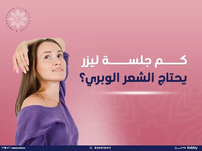 كم جلسة ليزر يحتاج الشعر الوبري؟ تجربتي مع ليزر ازالة الشعر الوبري