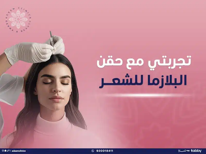 تجربتي مع حقن البلازما للشعر: تعليمات قبل وبعد وأسرار لن يخبرك بها أحد😉؟