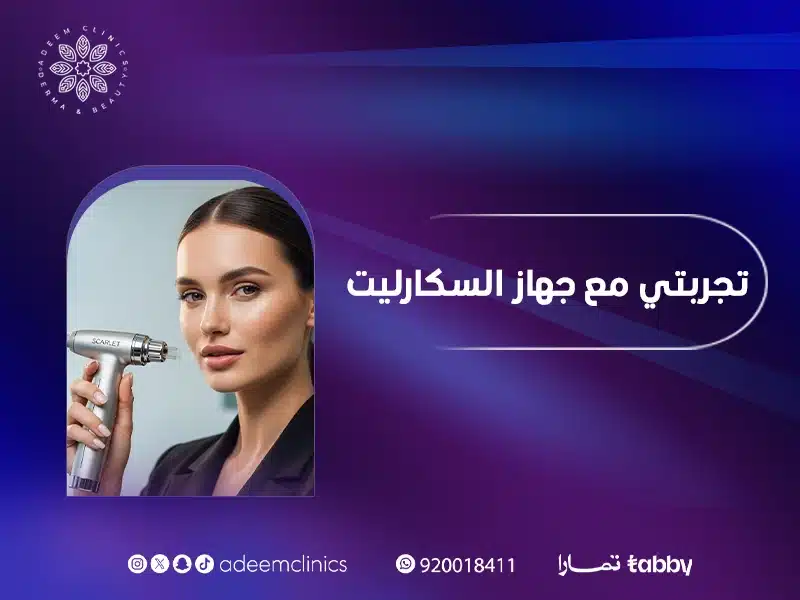 تجربتي مع جهاز سكارليت