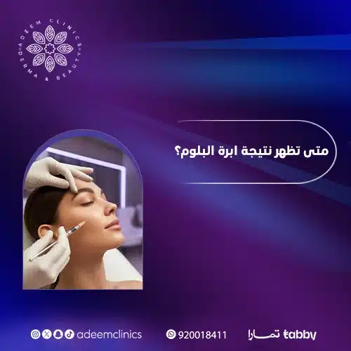 متى تظهر نتيجة ابرة البلوم