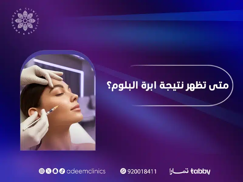 متى تظهر نتيجة ابرة البلوم