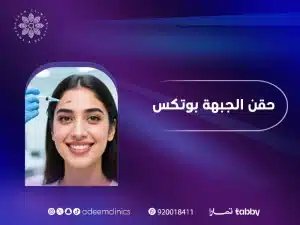 حقن الجبهة بوتكس: دليلك الكامل لإخفاء التجاعيد مع بوتكس الجبهة في اليرموك✨