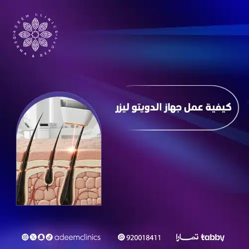 تجربتي مع جهاز دويتو ليزر