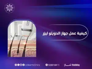  كيفية عمل جهاز الدويتو ليزر لإزالة الشعر : اسعار  جلسات الدويتو باليرموك