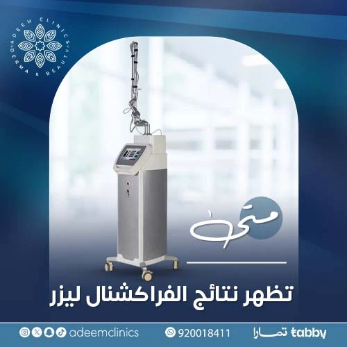 تجربتي مع الفراكشنال ليزر للوجه ✨