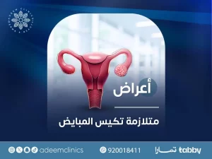 أعراض متلازمة تكيس المبايض