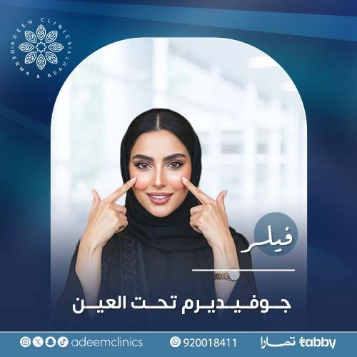 فيلر جوفيديرم تحت العين