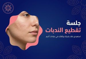 جلسة تقطيع الندبات: الحل الجذري لتحرير بشرتك من الحفر العميقة واستعادة الثقة