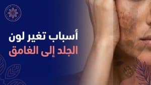 أسباب تغير لون الجلد إلى الغامق