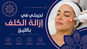 تجربتي في إزالة الكلف بالليزر: الحقيقة كاملة من البداية للنهاية